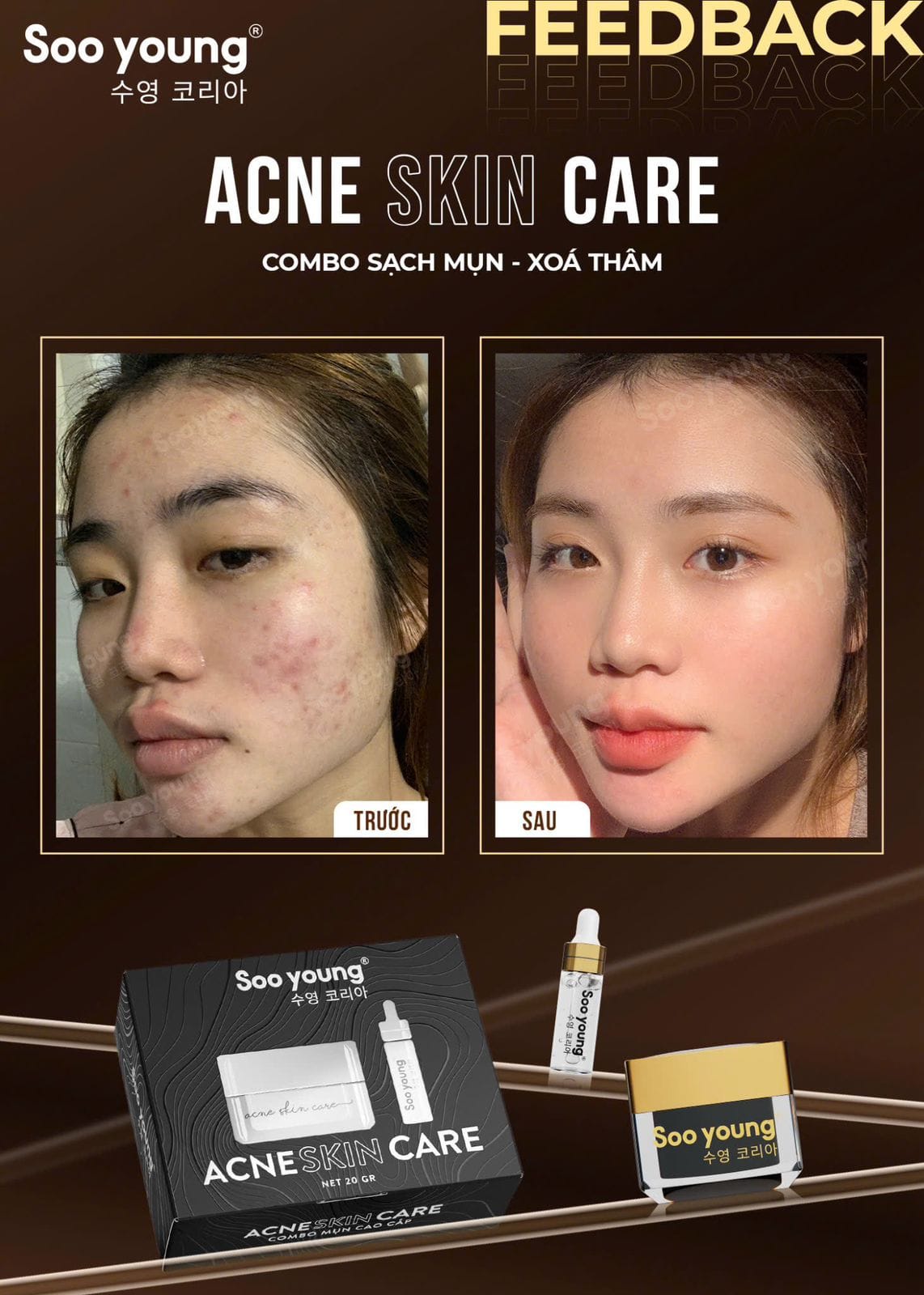 Acne Skin Care Soo Young Anti-Acne Combo Set