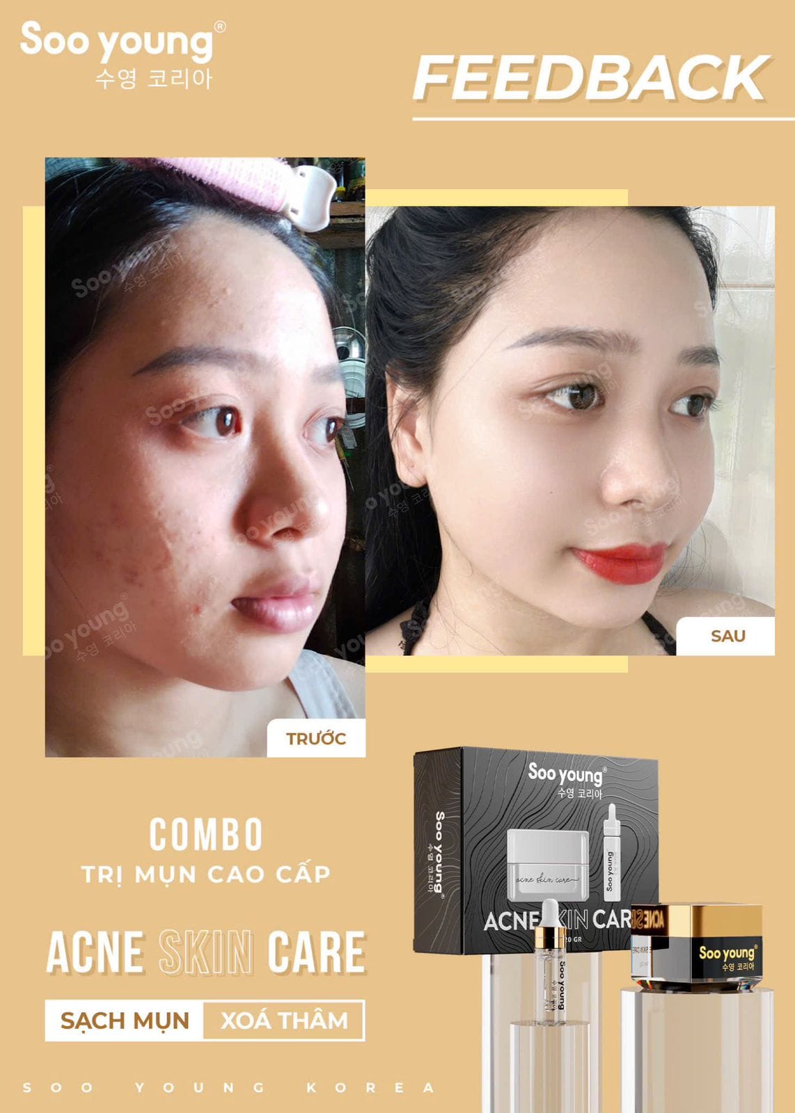 Acne Skin Care Soo Young Anti-Acne Combo Set