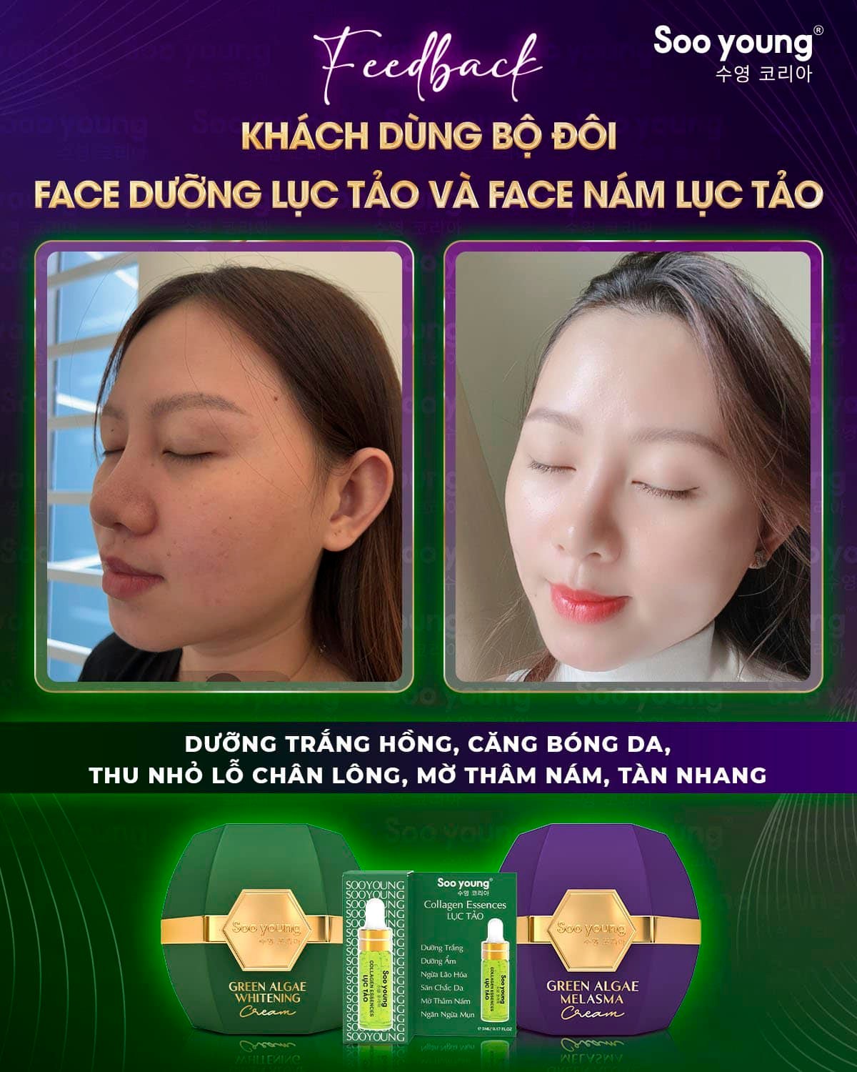 Soo Young Green Algae Day & Night Cream Combo Set 9