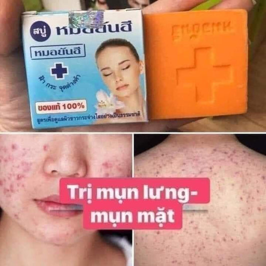 Dr. Yanhee Acne Soap