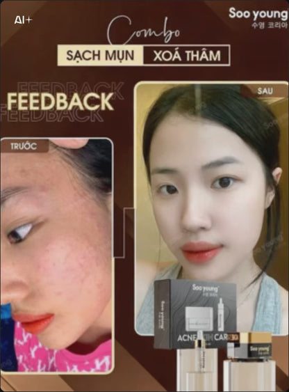 Acne Skin Care Soo Young Anti-Acne Combo Set